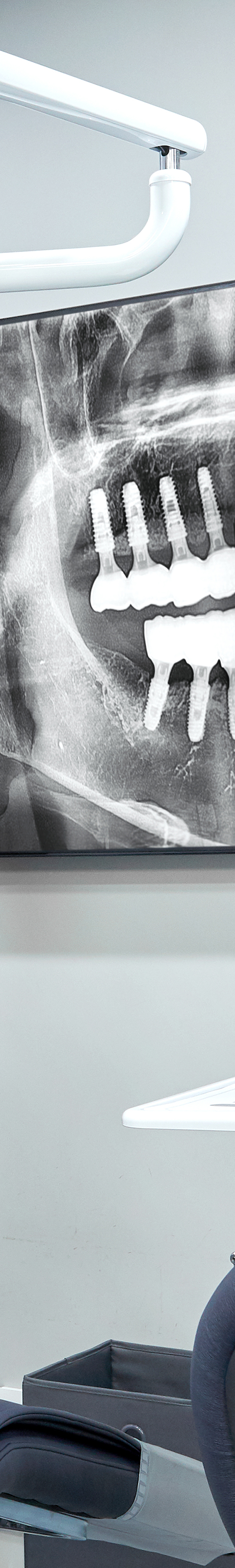 Dangsan Station Dental Clinic Sleep Implant Using Conscious Sedation image 29
