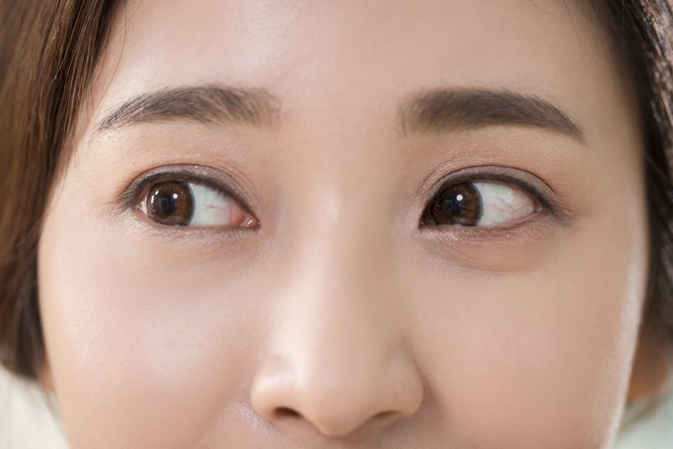 쌍수후머리감기 세수하기 언제부터 할 수 있나요? 관련 이미지 5