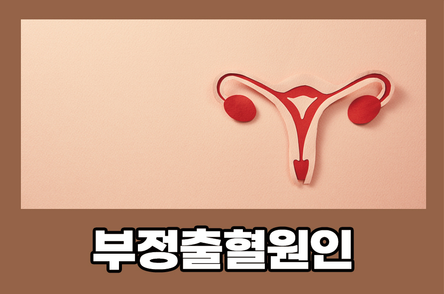 부정출혈원인 증상 치료 및 예방하는 방법에 대해 관련 이미지 1