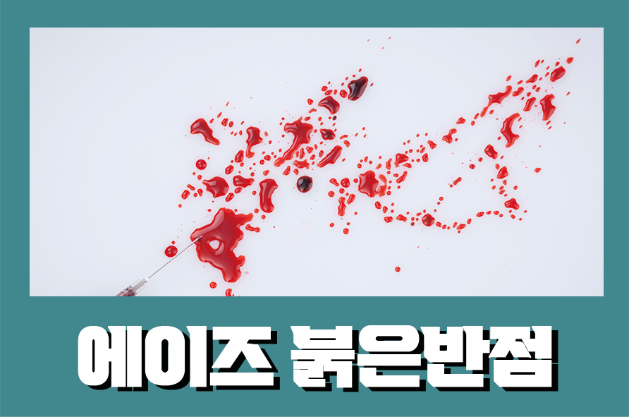 에이즈붉은반점 나타날 때 원인부터 진단방법은 관련 이미지 1