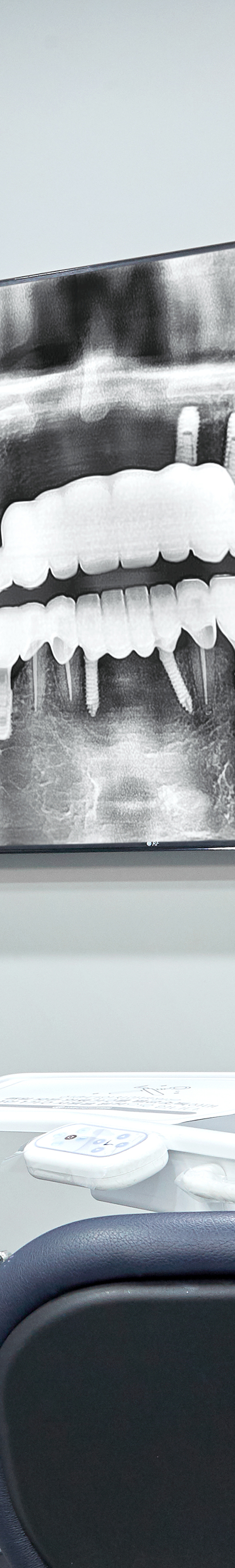 Dangsan Station Dental Clinic Sleep Implant Using Conscious Sedation image 30