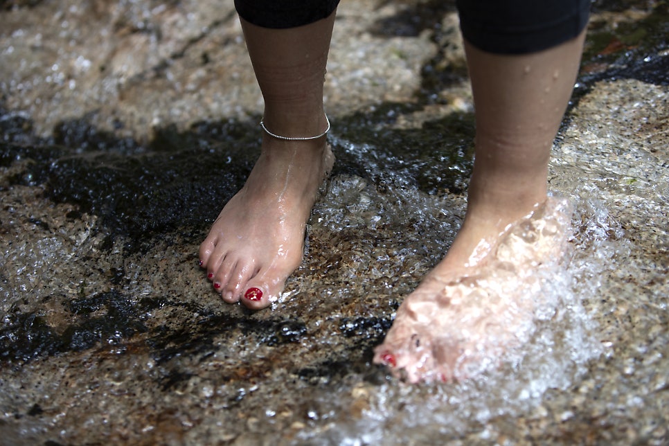 Causes of Toenail Bruising, Related Conditions, and Prevention image 4