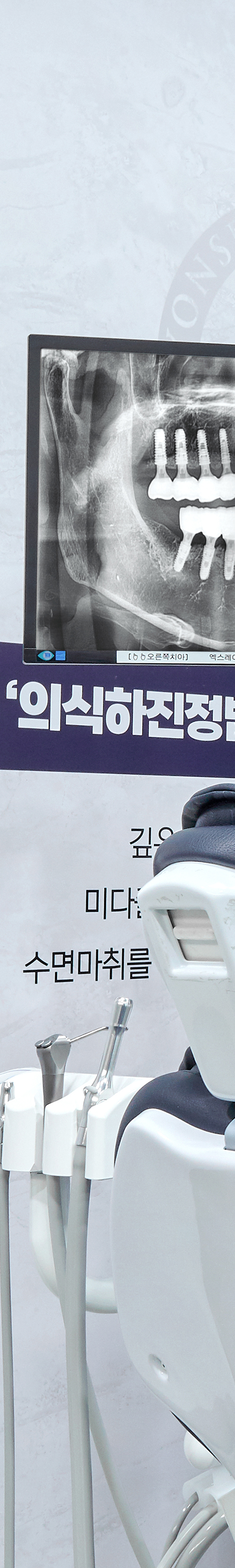 신도림역치과 임플란트식립 면밀한 검진을 통해 관련 이미지 38