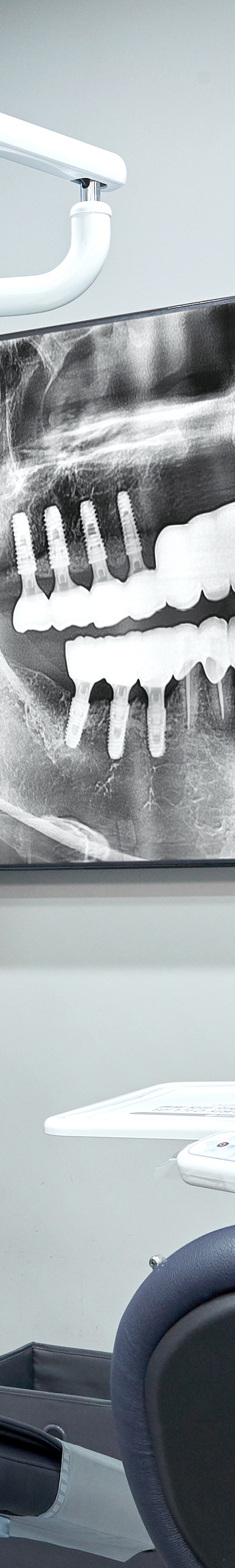 Yeouido Dental Clinic: Implant Treatment Period Depends on the Patient's Condition image 43