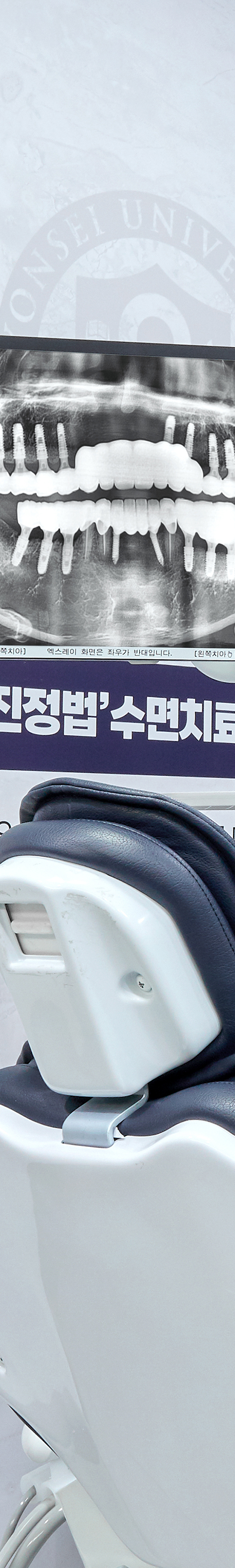 Yeouido Dental Clinic Implant Structure Similar to Natural Teeth image 39