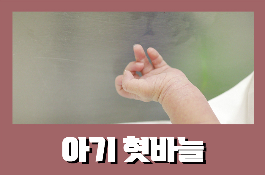 아기혓바늘 부모가 해야 할 대처방법 관련 이미지 1