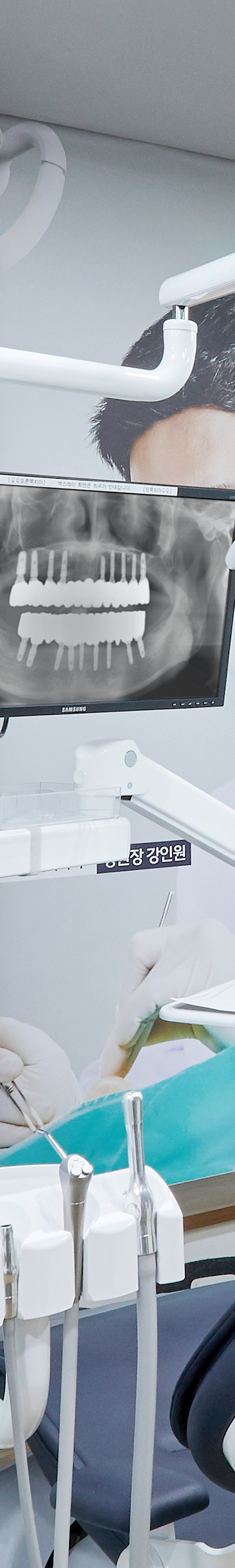 망원치과 임플란트치료 환자의 구강 상태에 따라 관련 이미지 17