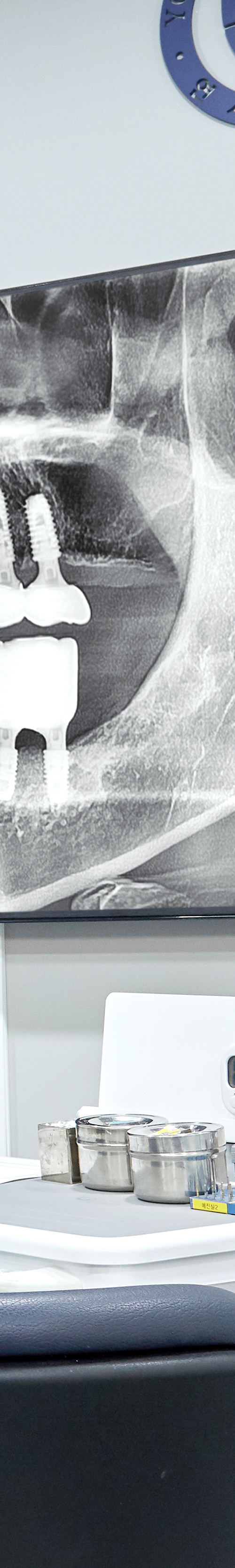 Yangpyeong-dong Dental Clinic: Treatment That Eases Concerns About Implant Procedures image 45