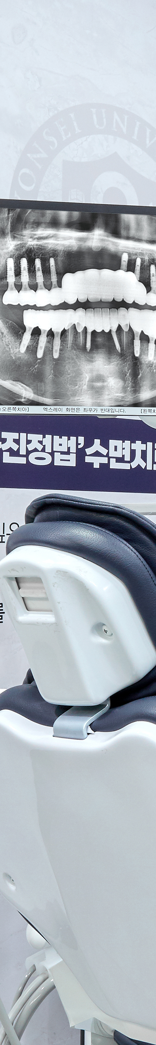 성산동치과 임플란트치료 안정성을 더한 시술을 관련 이미지 19