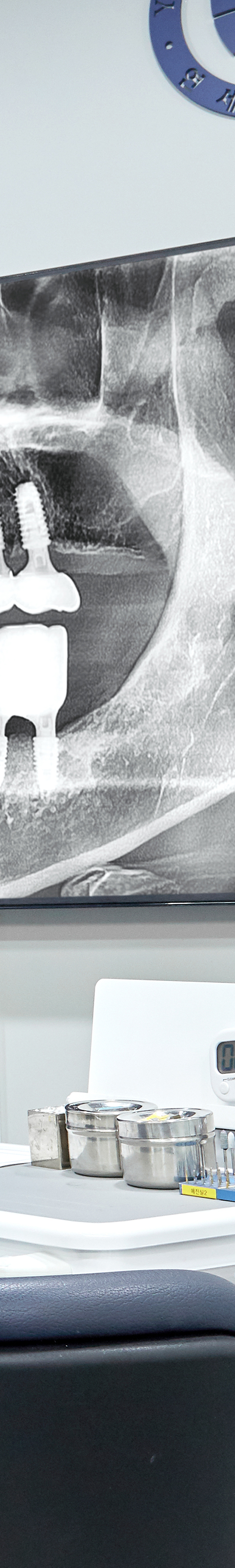 Mullae Station Dental Clinic — Sleep Implant Using Conscious Sedation image 45