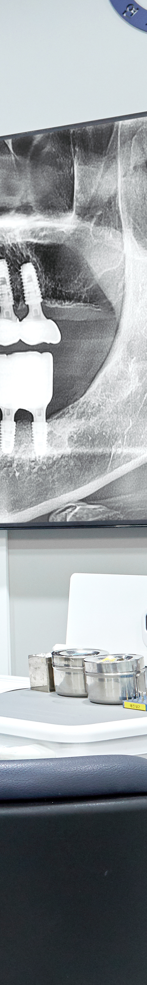 Shinchon Dental Clinic Implant Care Through a Careful Process image 25