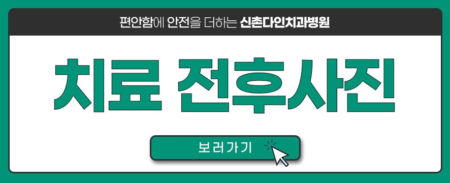 당산동치과 부분교정 부위에 따라 달라지는 관련 이미지 11