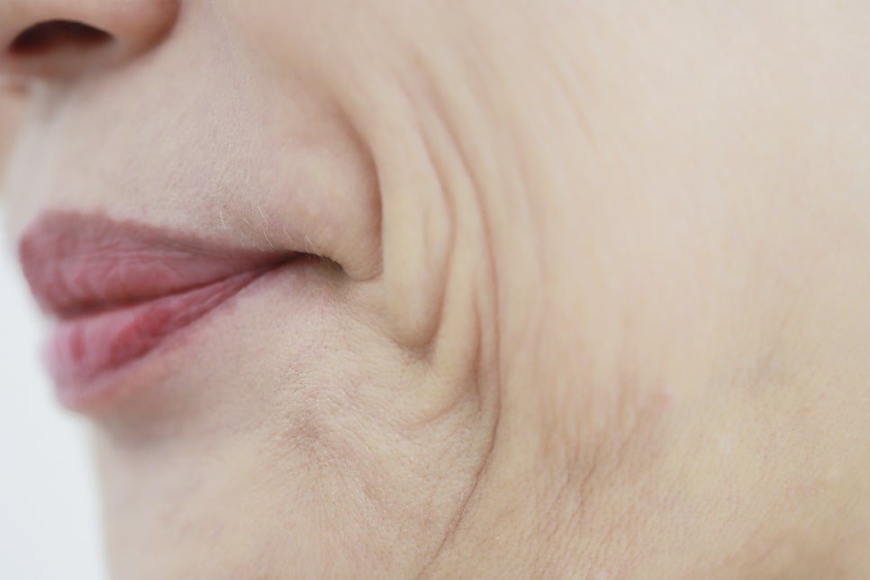 쇼그렌증후군 건조함 나타나면 적절 치료법은? 관련 이미지 5