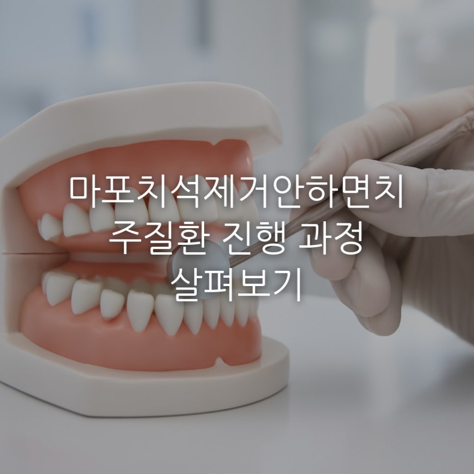 마포치석제거안하면치주질환 진행 과정 살펴보기 관련 이미지 1