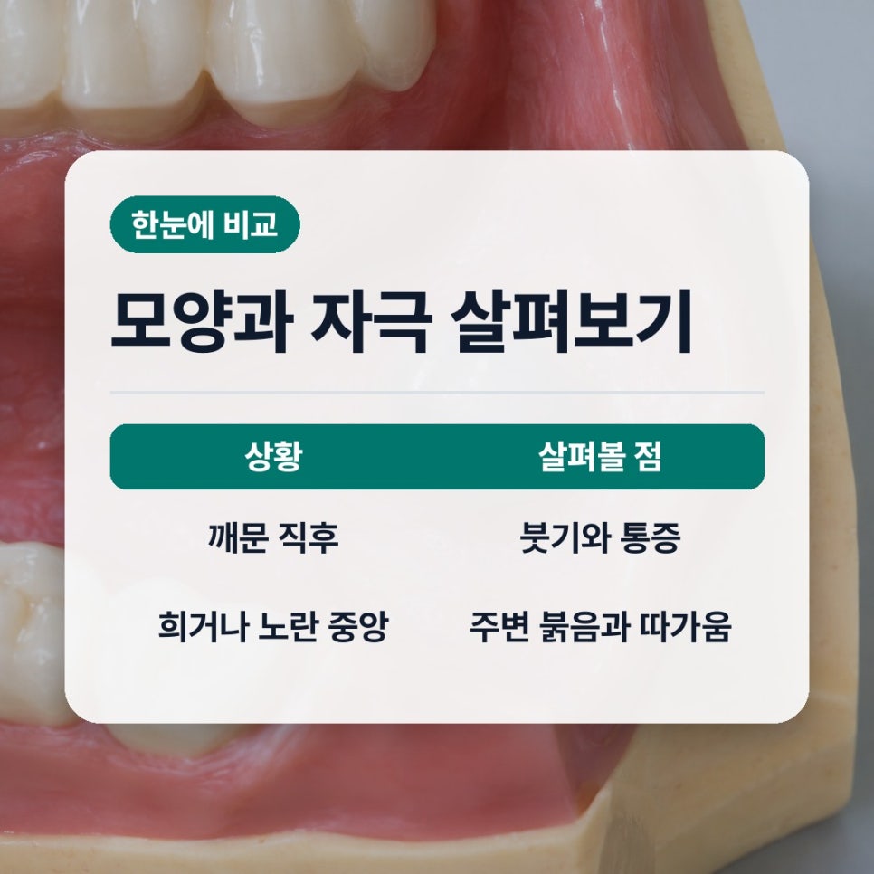 입술안쪽물집같은게생겼을때 직장인 반복되면 볼 신호 관련 이미지 2