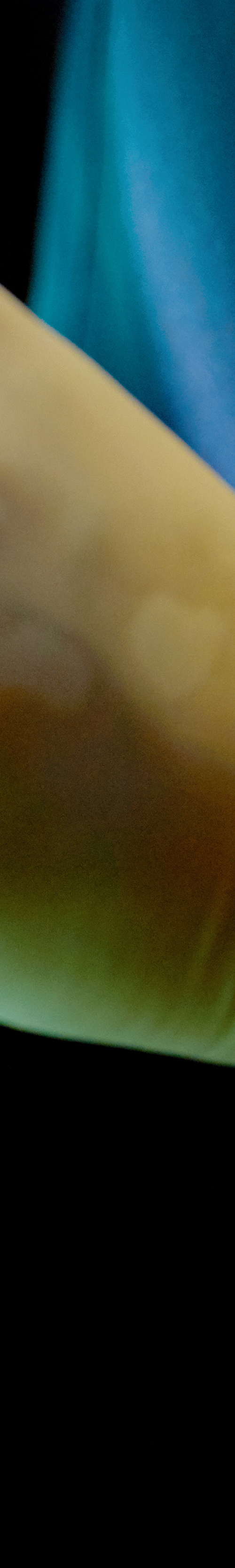 Yeongdeungpo Implant: Restoring Tooth Loss with Added Stability image 32