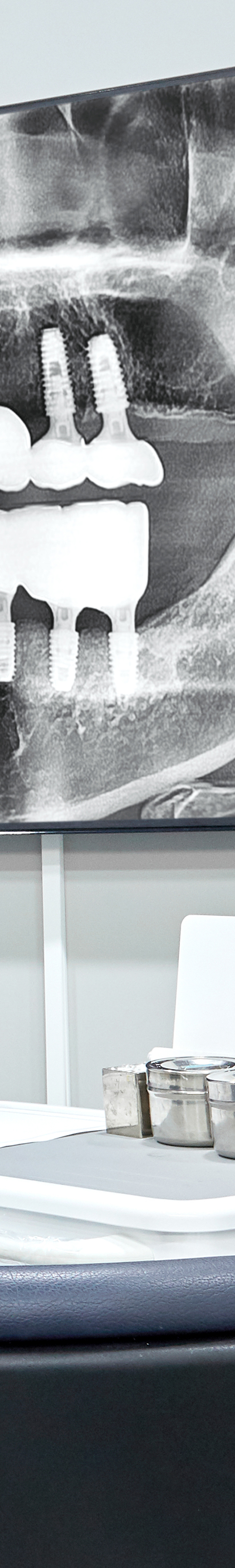 Yeongdeungpo Market Station Dental Clinic: Comfortable Under Conscious Sedation During Tooth Loss image 42