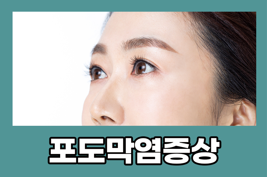 포도막염증상 원인과 관리 및 예방법으로는 관련 이미지 1