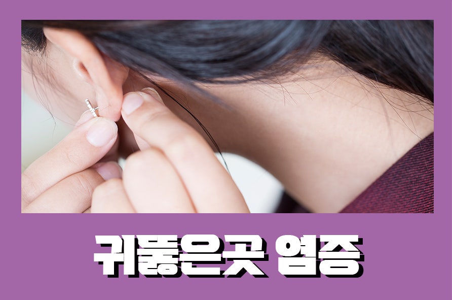 귀뚫은곳염증 초반에 관리하는 게 중요해요 관련 이미지 1