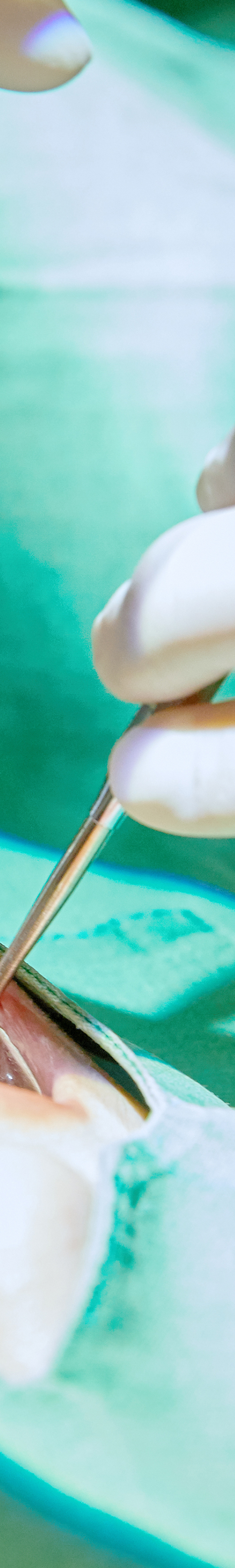 Hongdae Dental Clinic Implant Placement, Considering Oral Condition image 43