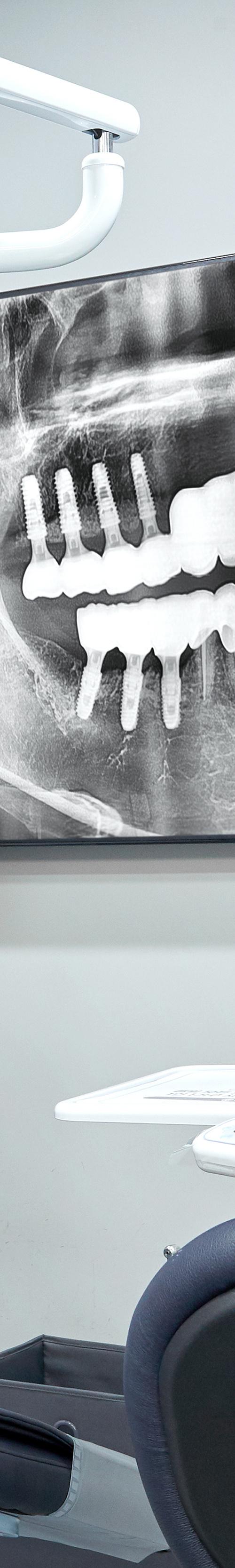 Dangsan Dental Clinic Implant Placement for Restoring Tooth Function image 23
