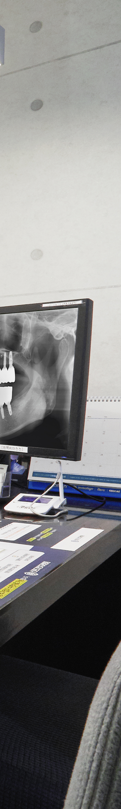 Dangsan Station Dental Clinic Implant Procedure with Thorough Aftercare image 45