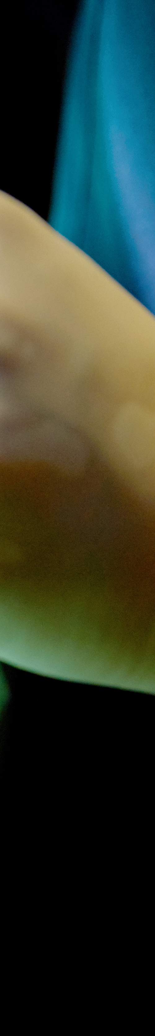 Dangsan Dental Clinic Implant Treatment in a Comfortable State image 32