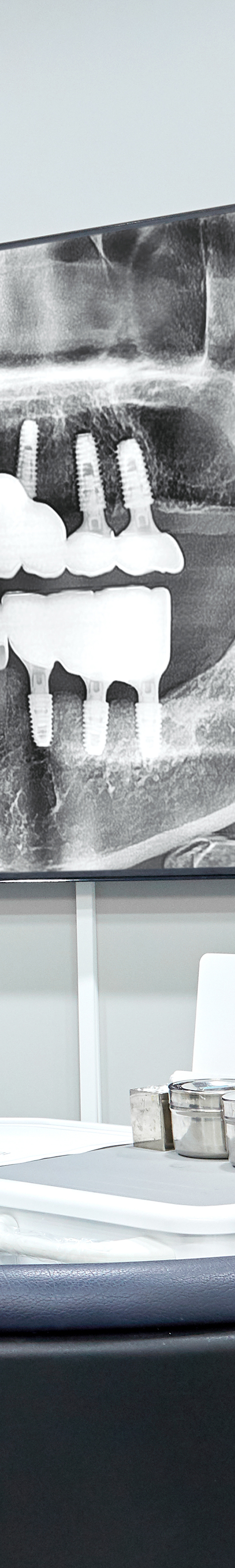 Mangwon-dong Dental Clinic Implant Procedure Based on Extensive Experience image 35