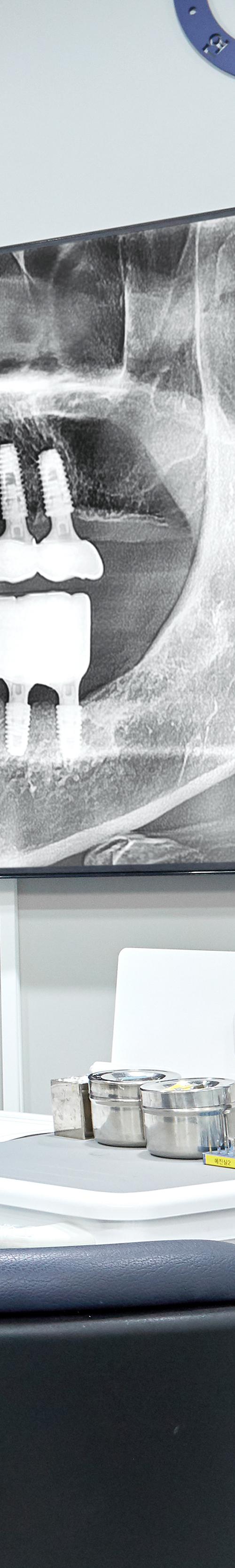 Yeouido Dental Clinic Implant Structure Similar to Natural Teeth image 45
