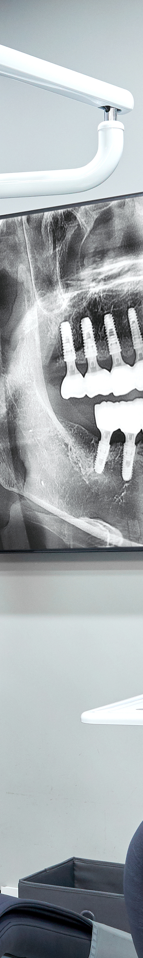 Yangpyeong Station Dental Clinic Implant Care with a Systematic Process image 23