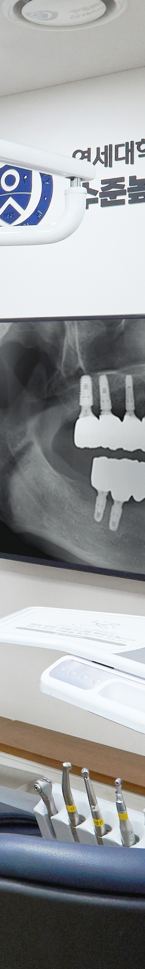 Yeongdeungpo Market Station Dental Clinic: Comfortable Under Conscious Sedation During Tooth Loss image 44
