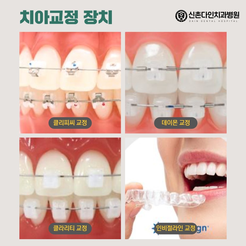 종로치과 치아교정 선택 신중해야 관련 이미지 6