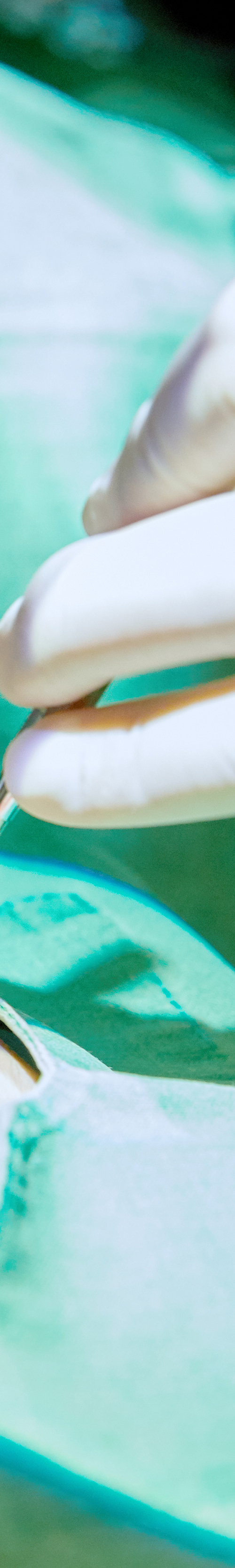 망원치과 임플란트치료 환자의 구강 상태에 따라 관련 이미지 33