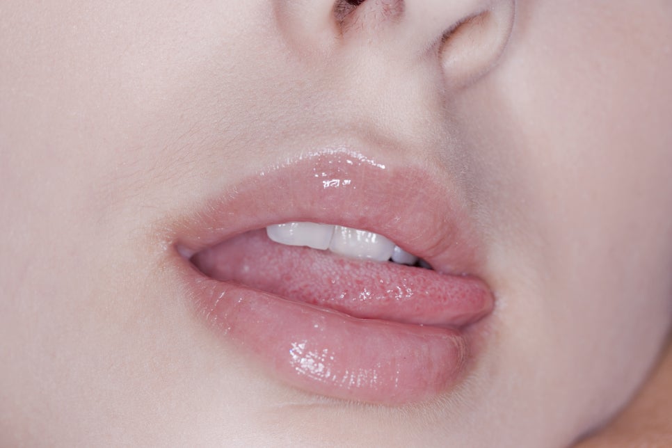 혀데었을때 응급조치가 중요해요 관련 이미지 5