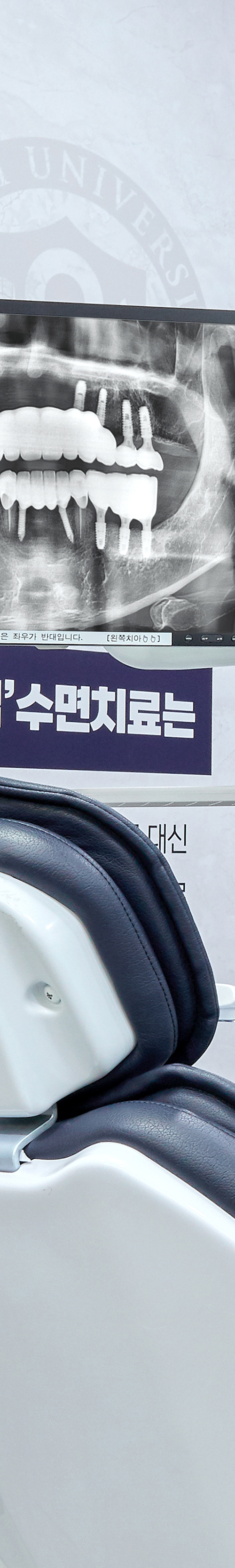 Hapjeong Station Dental Clinic Implant Treatment Through an Appropriate Treatment Plan image 31