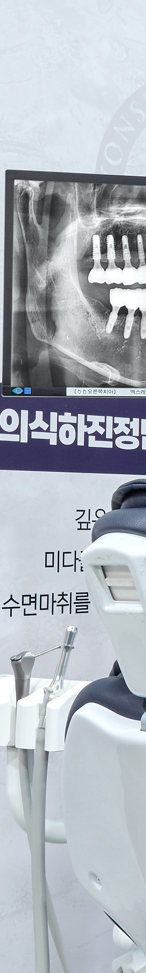 당산치과 의식하진정법 통해 편안한 임플란트 치료를 관련 이미지 18