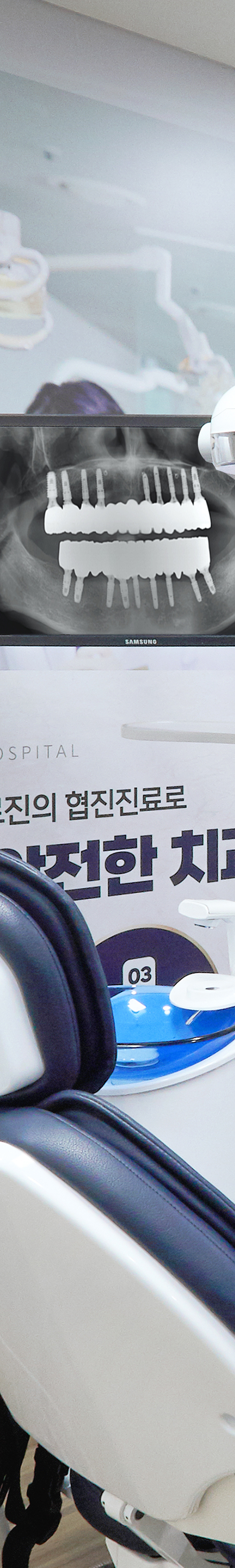 Yeongdeungpo Market Station Dental Clinic: Comfortable Under Conscious Sedation During Tooth Loss image 21