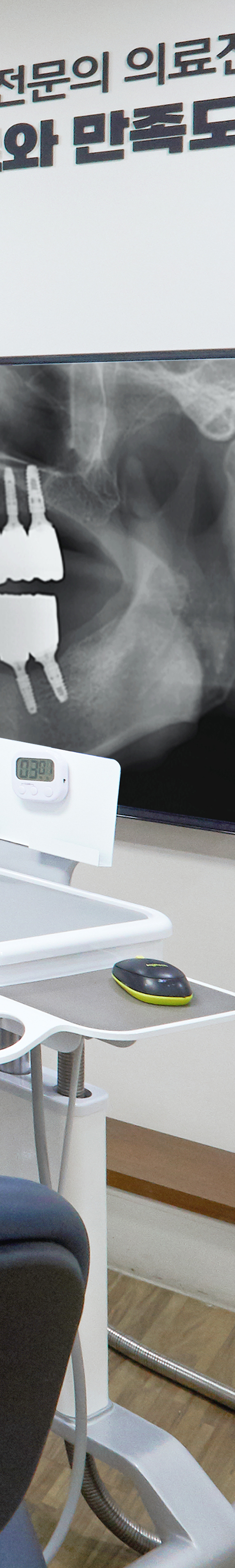 Shinchon Implant: To Help Prevent the Progression of Tooth Loss Symptoms image 45
