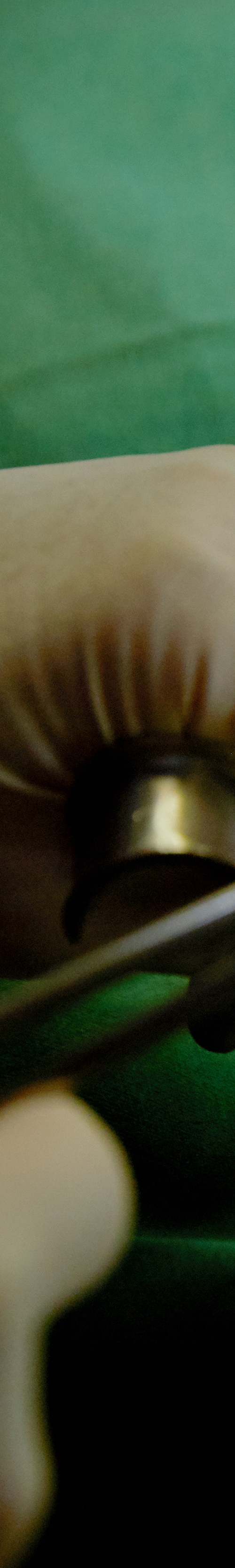 Dangsandong Dental Clinic Implant Care Through a Careful Process image 18
