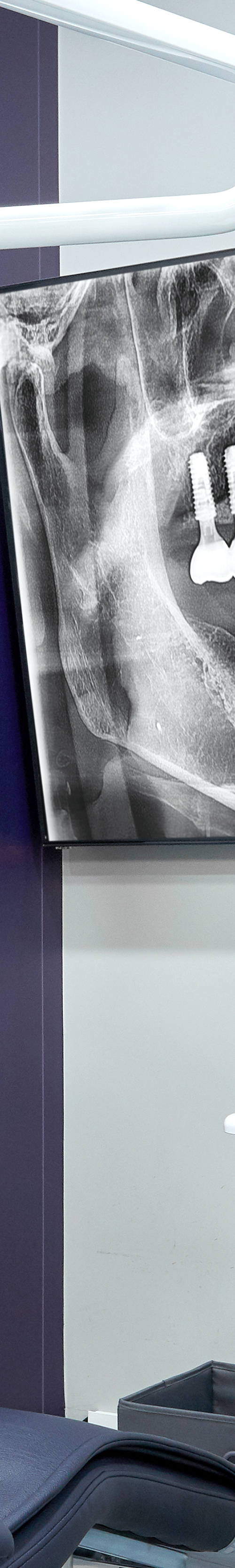 Treatment That Reduces Burden Through Conscious Sedation for Sinchon Dental Implants image 32