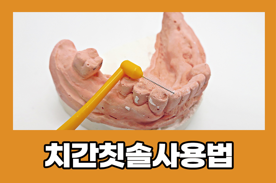 치간칫솔사용법 잘 모르고 있었다면 참고하세요! 관련 이미지 1