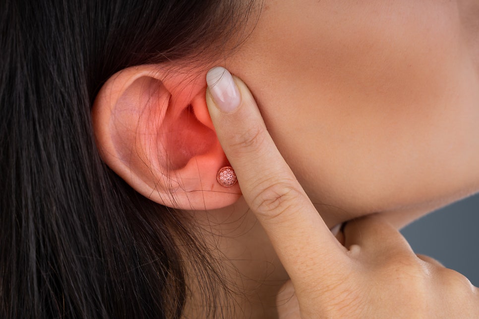 귀뚫은곳염증 초반에 관리하는 게 중요해요 관련 이미지 2