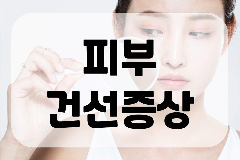 피부건선증상 원인과 관리와 예방법까지 관련 이미지 1
