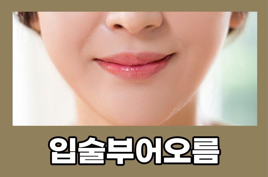 입술부어오름 증상 원인과 예방법 알아봐요 관련 이미지 1