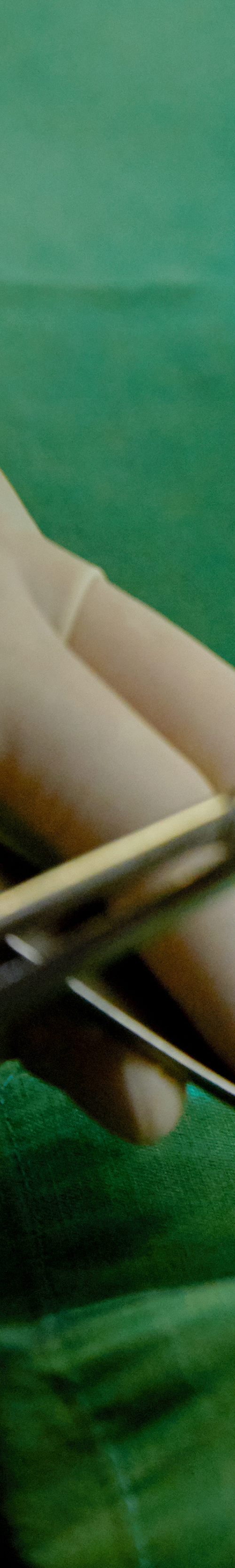 Hongdae Dental Clinic Implant Placement, Considering Oral Condition image 19