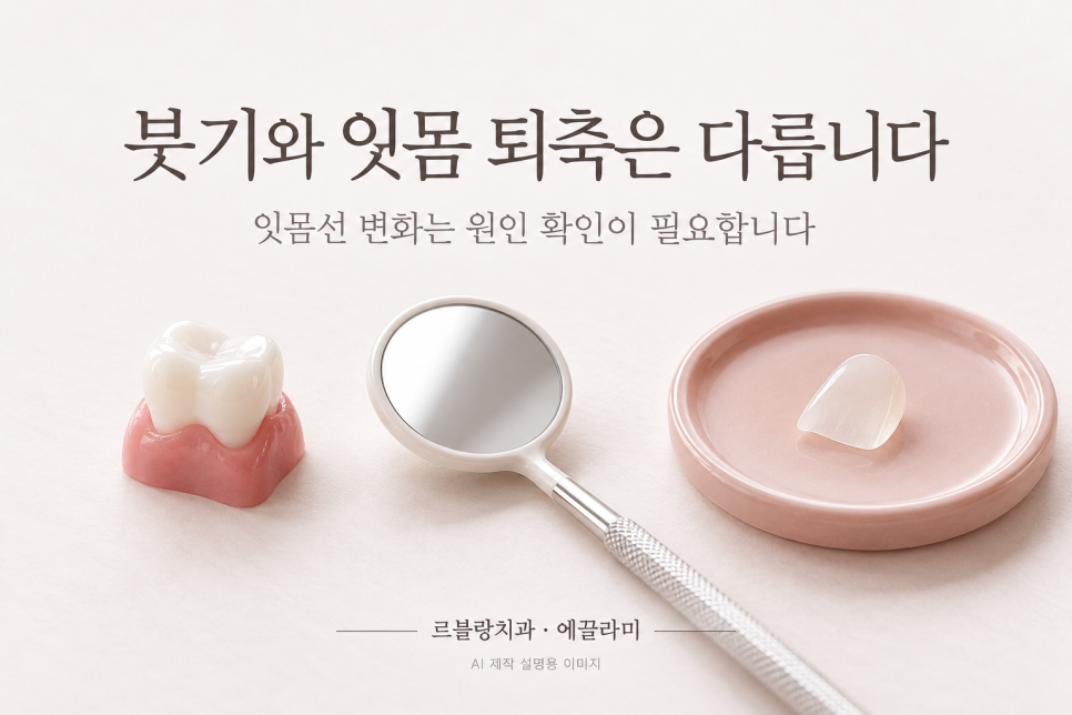 논현역치과 르블랑치과|라미네이트(에끌라미) 후 잇몸 모양이 달라 보인다면? 관련 이미지 2