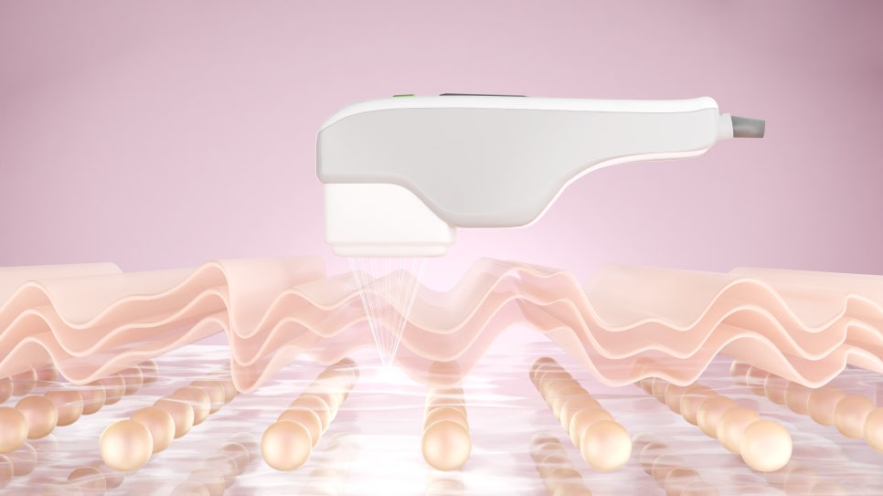 If You're Considering Oligio at Isu Station Dermatology, Come to Grini! image 4