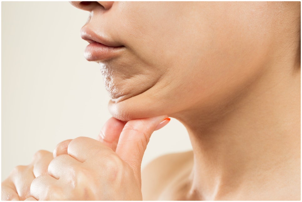 Isu Station Onda Lifting: Reducing Fat While Preserving Facial Contours image 2