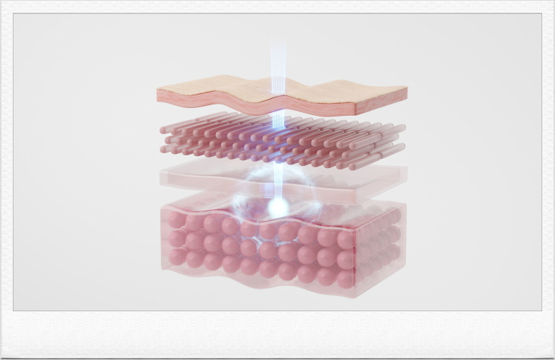 Bangbae-dong Dermatology, with Onda Lifting That Has Minimal Downtime image 3