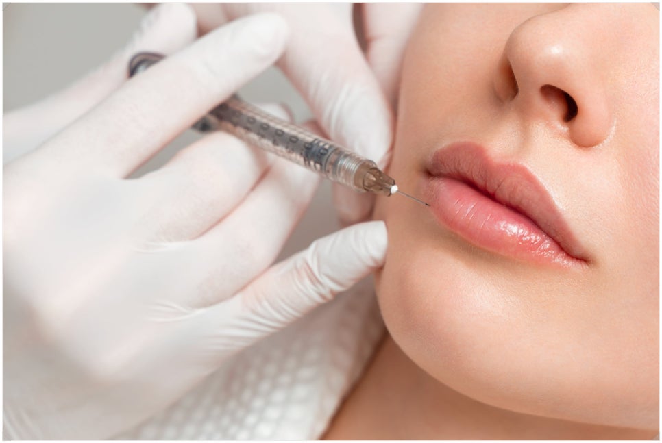 Bangbae-dong Lip Filler for Naturally Enhancing Volume image 3